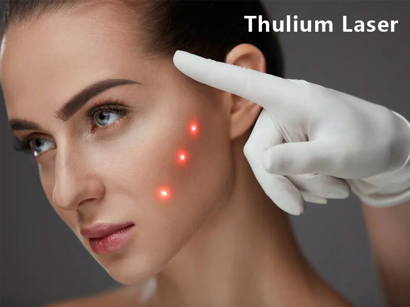 thulium laser machine