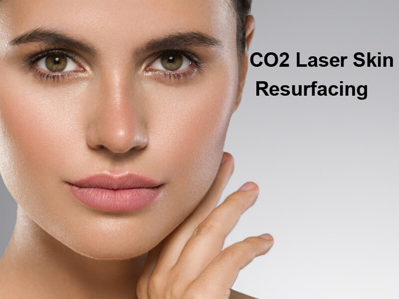 co2 fractional laser machine