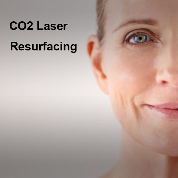 co2 laser machine