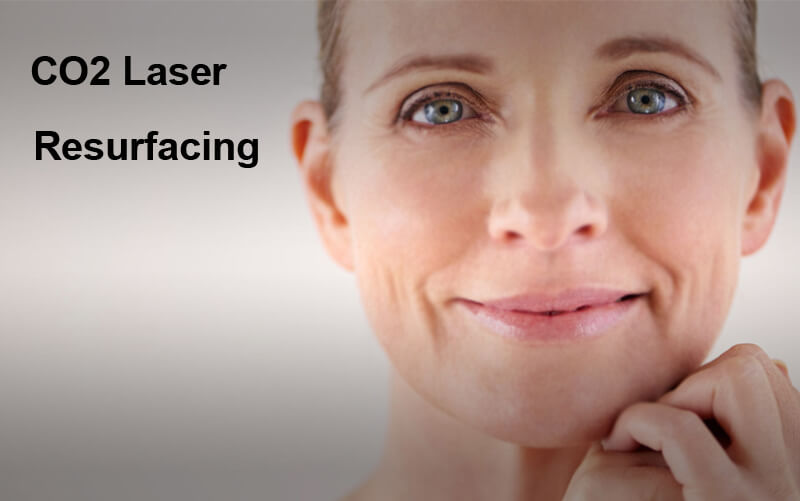 co2 laser skin resurfacing