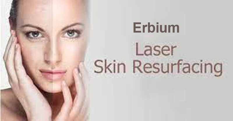 erbium laser machine
