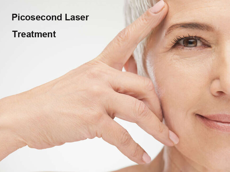 picosecond laser machine