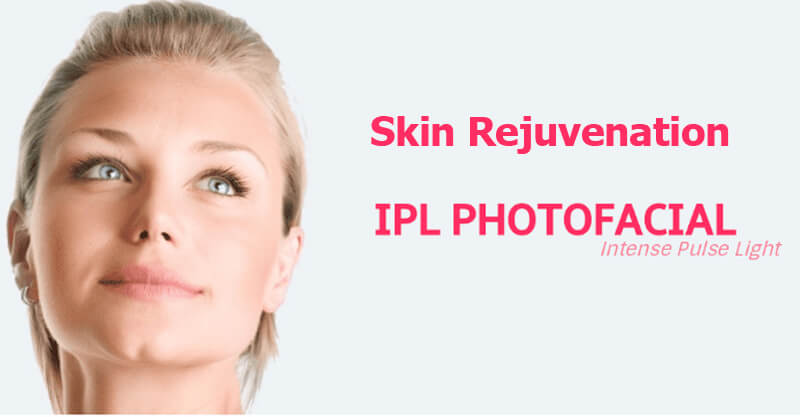 IPL skin rejuvenation machine