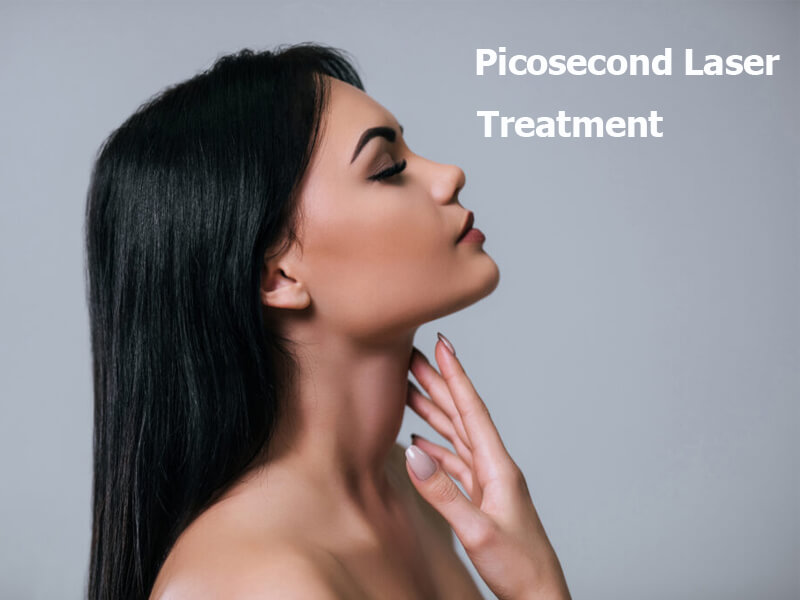 picosecond laser machine